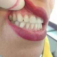 دندانسازی/دندان مصنوعی/بامجوزرسمی و ۸۰سال سابقه