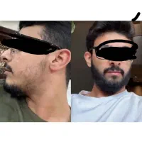 دوماهه تضمینی شیر میشی