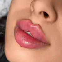 جشنواره کلینیک تخصصی ژل و بوتاکس