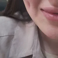 پیرسینگ چال گونه با بخیه