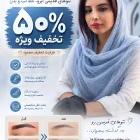 ریموو