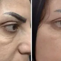 پک کرم و صابون ضدلک و روشن کننده صورت اصل|آرایشی، بهداشتی، درمانی|تهران, شهرک غرب|دیوار