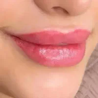 تخفیف ویژه خدمات دائم صورت