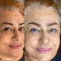 تاتو