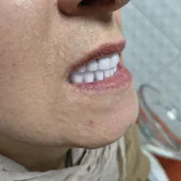 دندانسازی/پروتز ثابت و متحرک