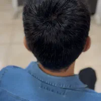 انواع پروتز کره ای اصل/اقساطی/بدون پیش