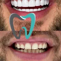خدمات دندانپزشکی درمانی/زیبایی توسط پزشک