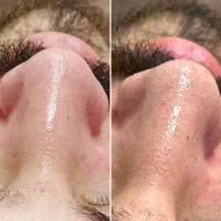 پاکسازی پوست