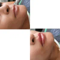 زیبایی|خدمات آرایشگری و زیبایی|ماهدشت, |دیوار