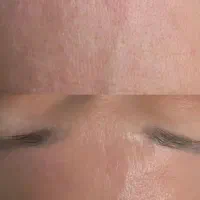 فیشیال پاکسازی پوست
