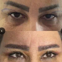 تخفیف ویژه جراحی های زیبایی ( جراحی بینی۴۰)