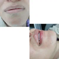 زیبایی|خدمات آرایشگری و زیبایی|ماهدشت, |دیوار