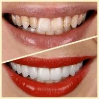 آخرین فرصت ویژه کامپوزیت( از دم قسط+ آف ویژه)
