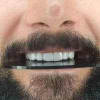کامپوزیت هر فک (۸ واحد) فقط ۶ میلیون تومان