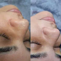 خدمات پاکسازی، فیشال و جوانسازی پوست