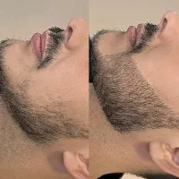 رویش ریش و‌پرپشتی