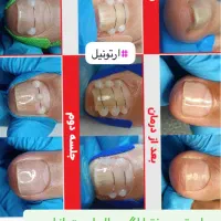 آموزش پدیکور بانوان