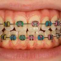 استخدام دستیار ارتودنسی