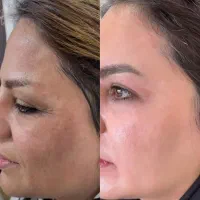 قوی ترین روشن کننده و ضد لک جهانی