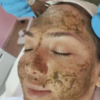آموزش فوق تخصصی پاکسازی و فیشال(فیشیال)