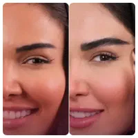 نیازمند مدل کاشت ابرو با شرایط ویژه