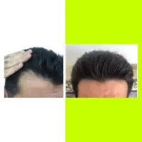 تاسی سرداری یاریشات پرپشت نیست