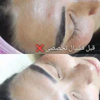 مدل فشیال صورت 400