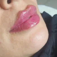 مدل برای ژل لب فقط ۵ نفر