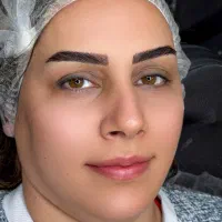 میکروبلیدینگ