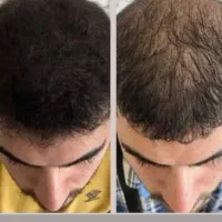 پی ار پی ممنوع