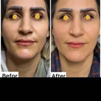 کمپلوخیابان بنی هاشم بین فرهانی وزینب مرکزرفاه