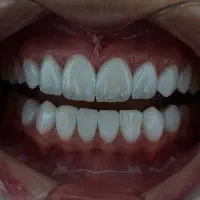 خدمات تخصصی زیبایی دندان