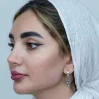 تخفیف ژل و بوتاکس و نخ و جوانساز در کیلینیک