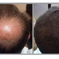 هنوز تو فکر کاشتی