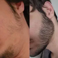 دائمی بلندش کن