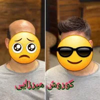 نصب پروتزمو/تعویض چسب پروتزمو/ترمیم/درمحل/وسالنvip
