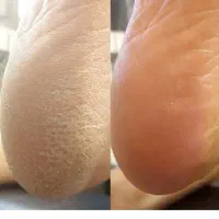 پدیکور پا فقط فقط ۳۵۰