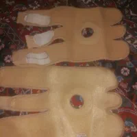 زانو بند
