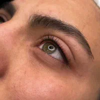 فیبروز،بن مژه،شیدینگ لب