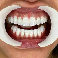 دندانپزشکی زیبایی نقدواقساط