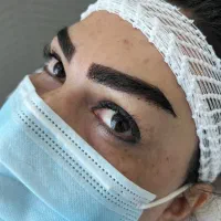 کاشت مو وابرو طبیعی با ضمانت نامه