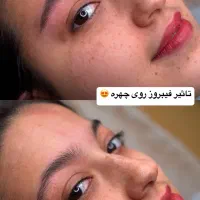 فیبروز ابرو‌ سوپرنچرال فقط ۷۰۰هزارتومان
