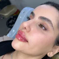 تزریق ژل لب روسی و بوتاکس و فیلم بادی