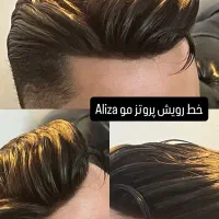 پروتز مو و چسب پروتز مو شیراز Aliza