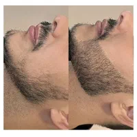 پسرایی که ریش ندارن چین