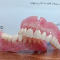 جشنواره ویژه دندان مصنوعی فقط ۵ میلیون
