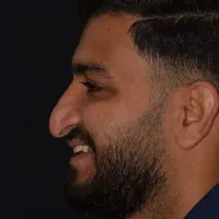 عمل زیبایی بینی ۵۵ ملیون