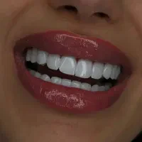 خدمات دندانپزشکی نصف قیمت در لرستان