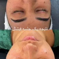 پاکسازی و فیشال پوست حرفه ایی