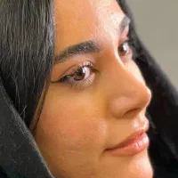 عمل جراحی بینی /لیفت صورت